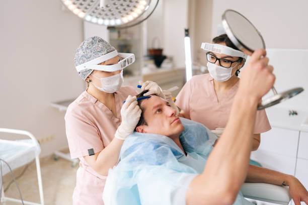 Hair Transplant in Riyadh