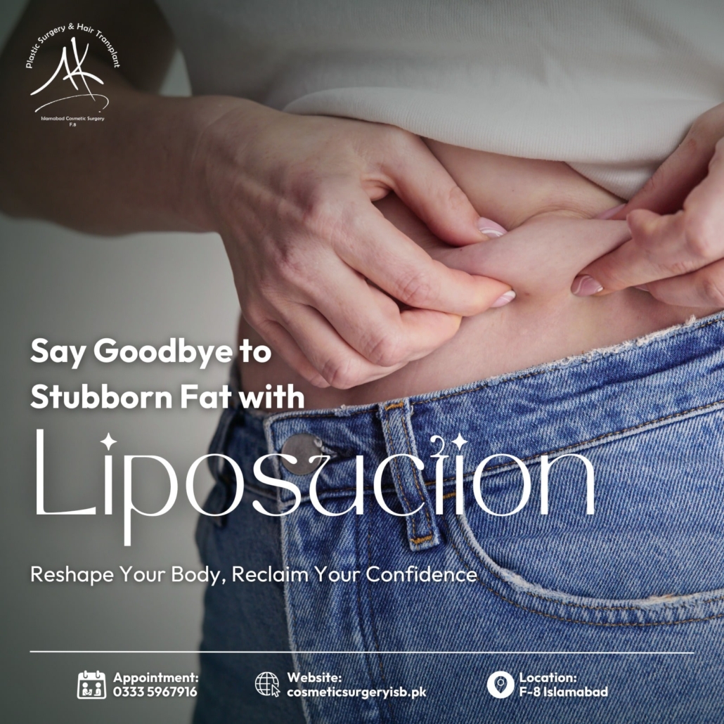 Liposuction in Islamabad