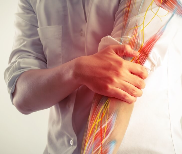 nerve pain