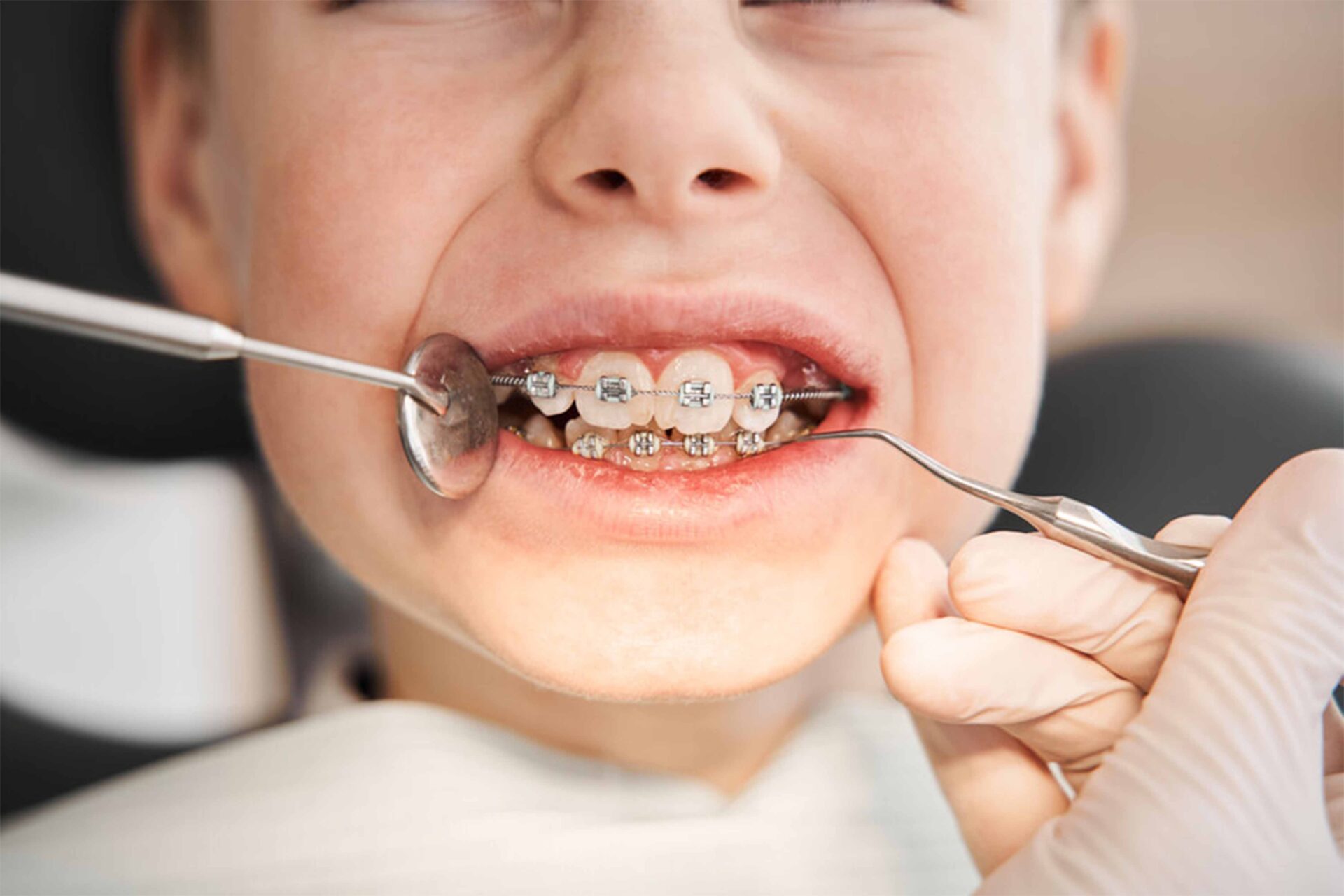 Braces cost in Pakistan