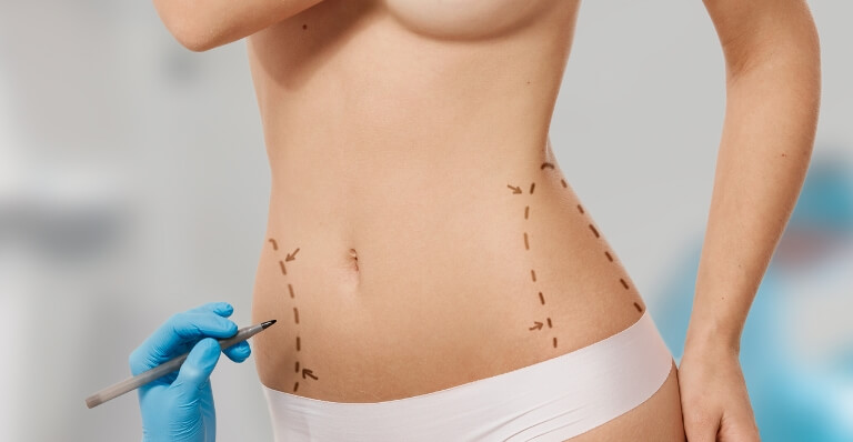 Liposuction in Islamabad