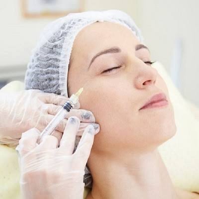 When Should You Consider Botox for Excessive Sweating?